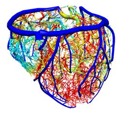 heart model
